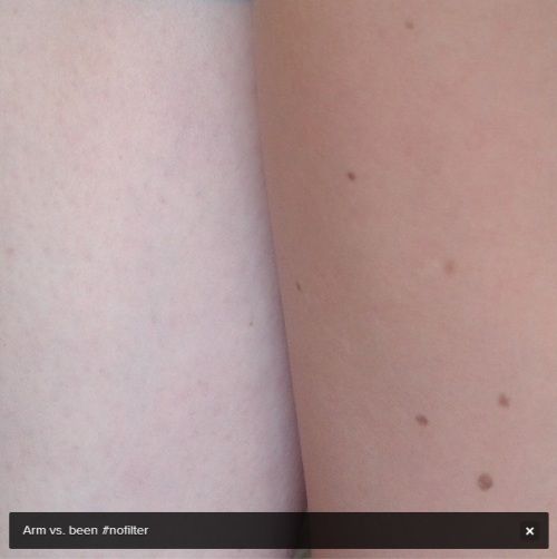 photo armenbenenkleurverschil.jpg