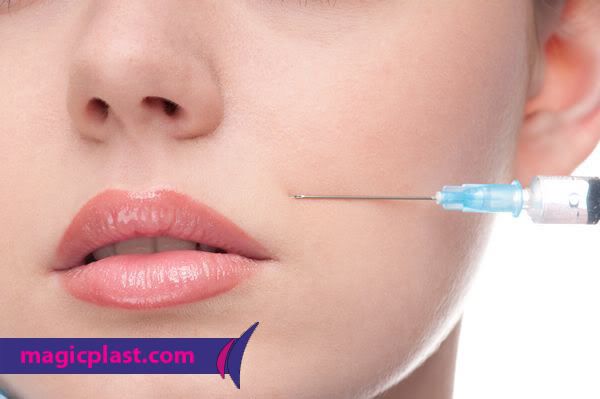 liposuction liposuction