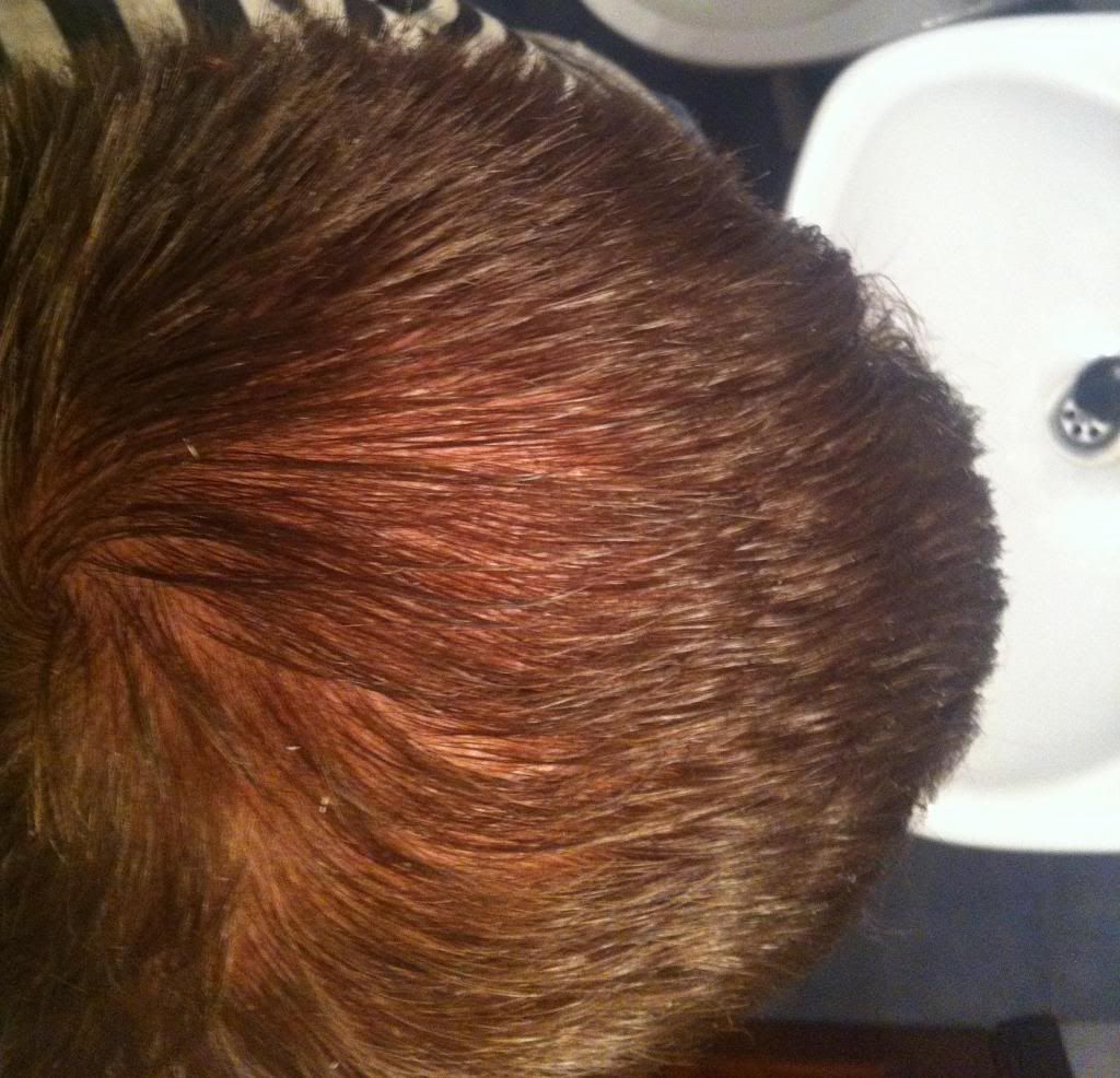 no efecto finasteride el me hace